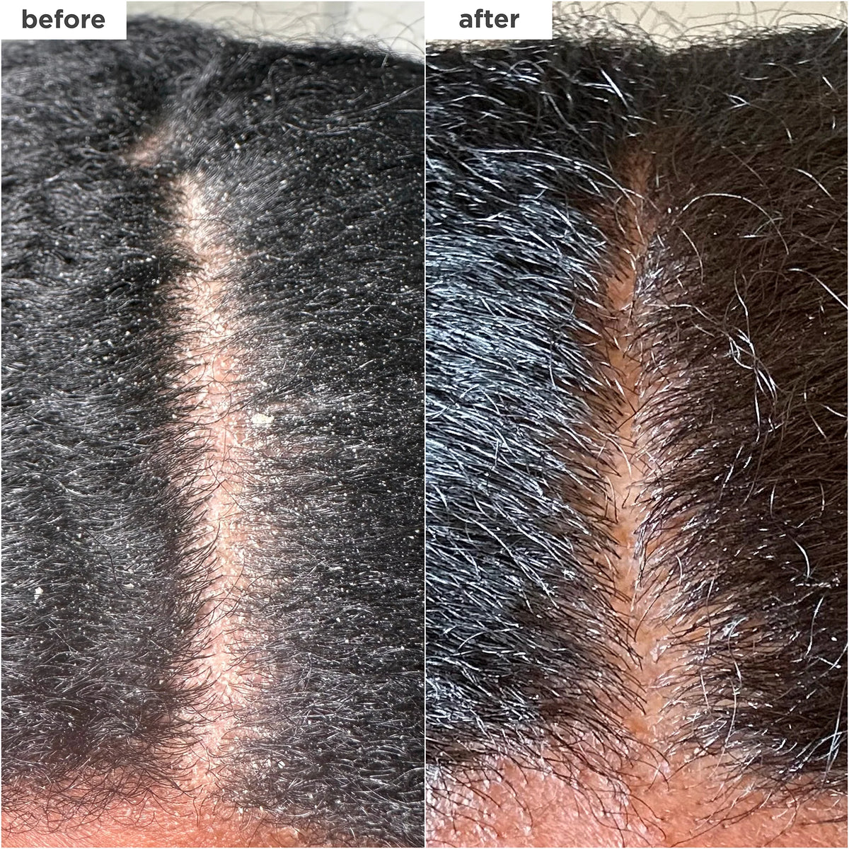 Briogeo Scalp Revival MegaStrength + Dandruff Relief Shampoo